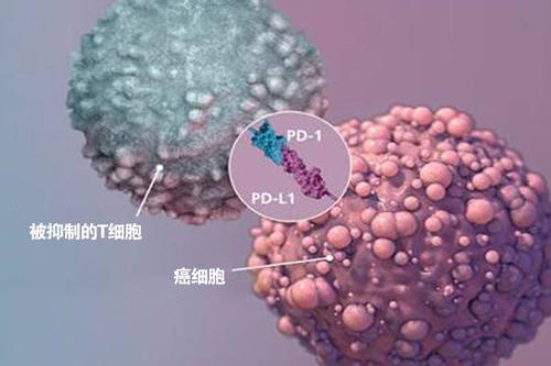 针对髓样细胞的新型癌症免疫疗法可以减缓肿瘤生长