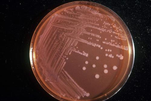 美国最后一种抗生素对沙门氏菌有抗药性