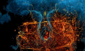 新的X射线显微镜技术可对密集的神经回路进行全面成像