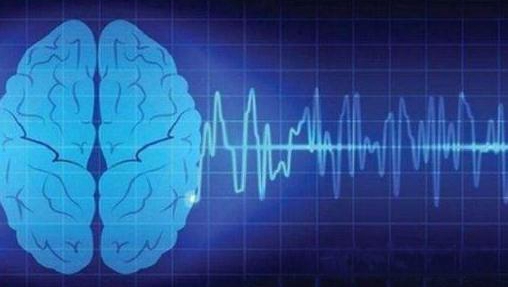 研究人员发现精神病患者有缺陷的脑信号可以通过药物治疗来改变
