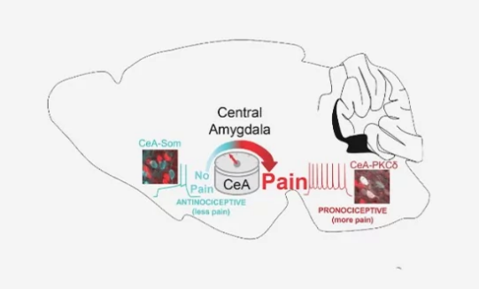 鼠标研究可以解释大脑如何使疼痛向上或向下转动