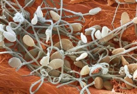 研究人员在人类精子尾巴中发现的新结构