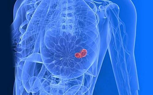科学家们正在开发一种新的方法来识别不同类型乳腺癌的独特化学指纹