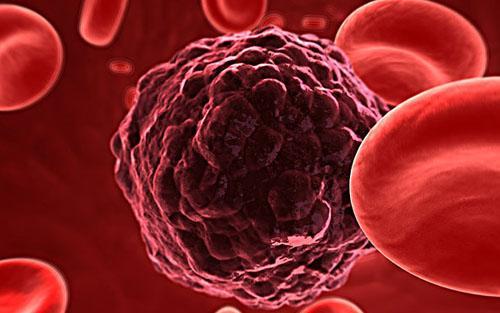 基于血液的生物标记物为预测癌症复发设定了新标准