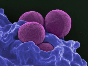 基因突变可帮助超级细菌对抗生素产生高度耐药性