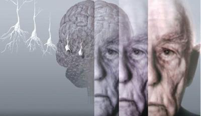 个人知觉可能是早期发现阿尔茨海默氏病的重要指标