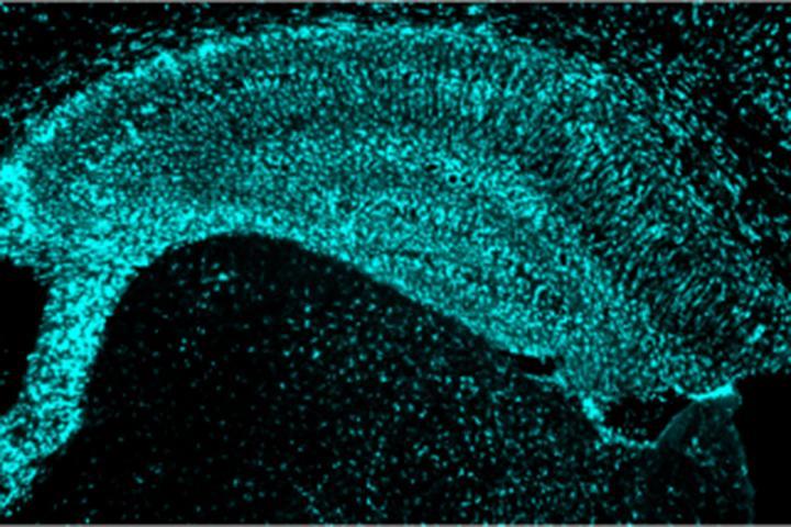 脑蛋白减少小鼠阿尔茨海默病样脑损伤