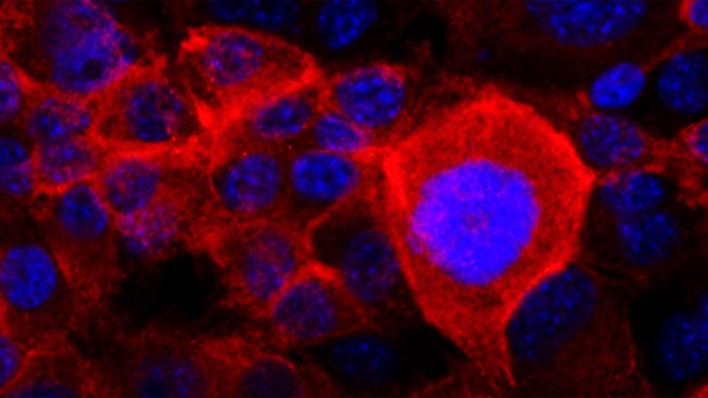 胰腺癌细胞如何躲避药物治疗