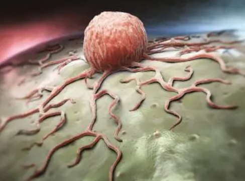 研究人员确定乳腺癌细胞如何获得抗性特征
