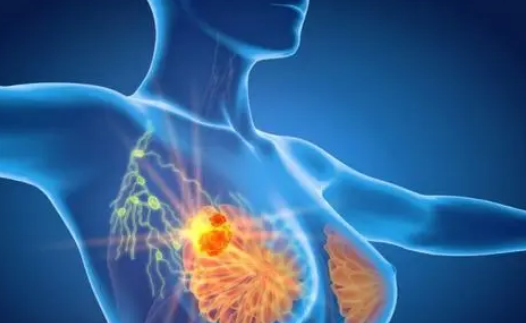 关于侵袭性乳腺癌的有希望的新研究