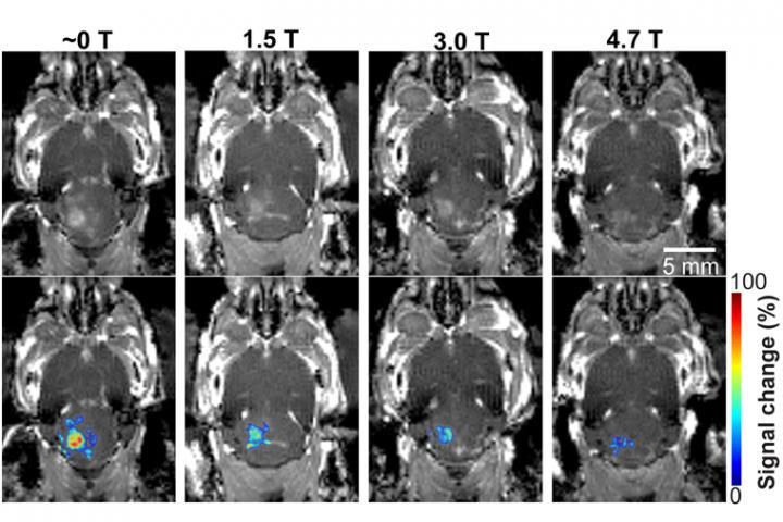 来自MRI的磁场影响聚焦超声介导的血脑屏障