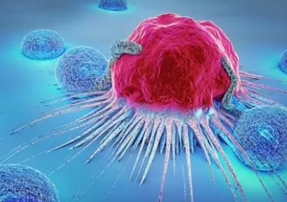 无论基因突变状态如何 晚期膀胱癌对免疫疗法都有反应