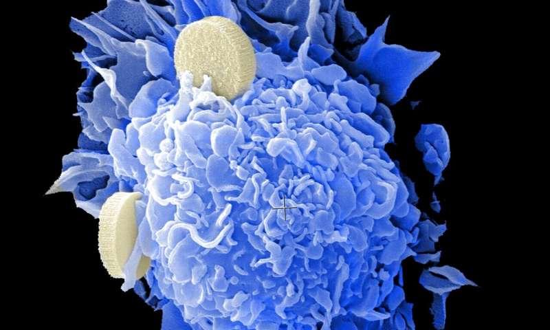 基因组测试可以帮助预测新诊断为前列腺癌的男性的侵袭性疾病