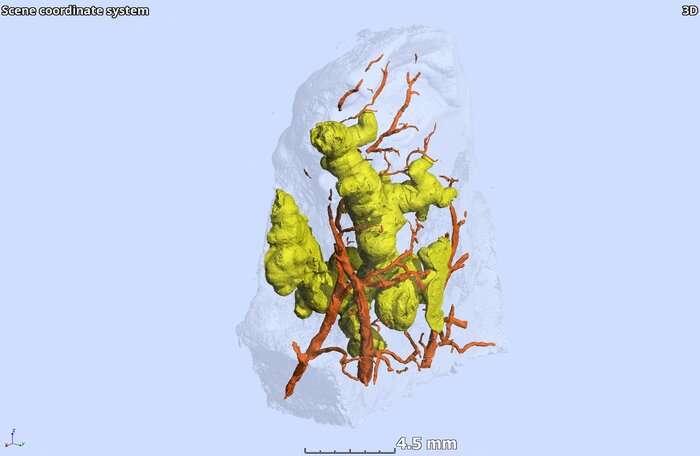 结核病肉芽肿的第一个3-D视图改变了它们的形状和形成的范式
