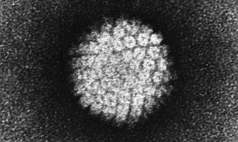 研究人员表明β皮肤 HPV可能是鳞状细胞癌的预测因子