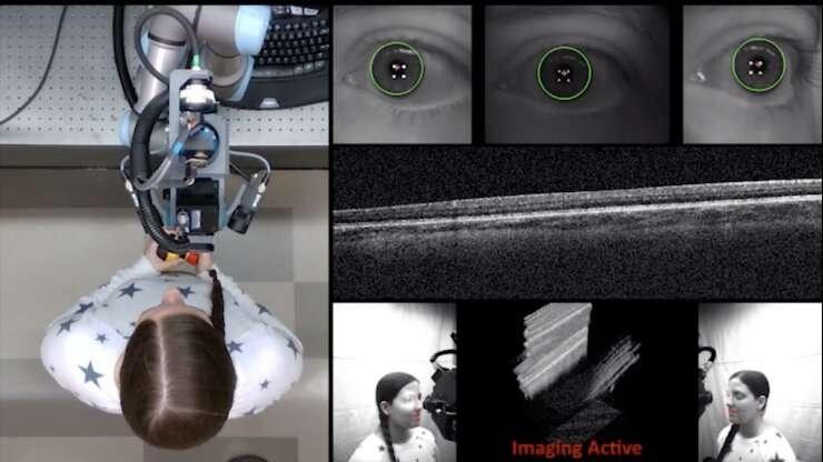 机器人扫描仪可自动进行眼部诊断成像