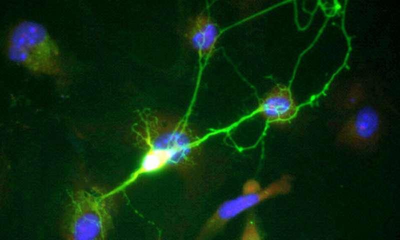 新研究发现触敏神经元以更加混乱和混乱的方式传达触摸