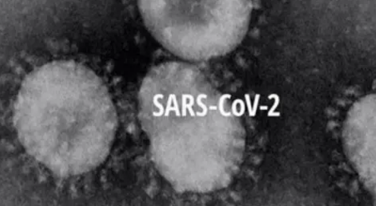 现有药物可杀死细胞中的SARS-CoV2