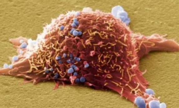 Wistar科学家揭示了通过干扰癌细胞代谢来阻止肿瘤抑制机制