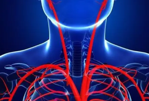 颈动脉手术和支架置入术对中风的长期影响相似
