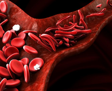 血小板介导的有益过敏反应可预防酵母菌哮喘