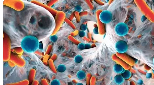 Mayo研究人员将肠道微生物组与类风湿性关节炎预后联系起来