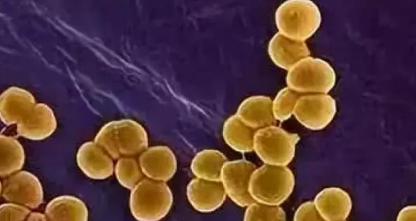 研究人员探索MRSA超级细菌最有希望的治疗方法
