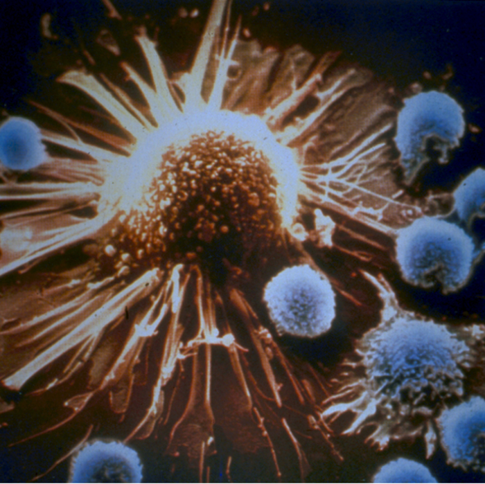 正确的程序可以将免疫细胞变成癌症杀手
