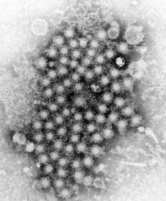 NIAID科学家发现丙型肝炎进入细胞的关键