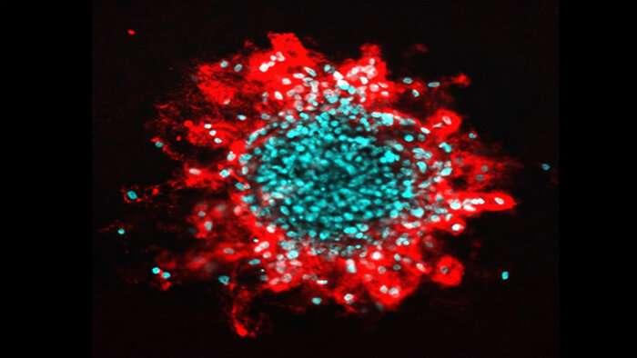 细胞核破裂如何促进乳腺癌的肿瘤侵袭