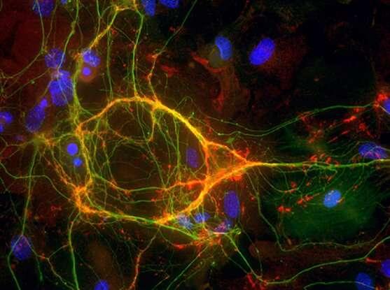 两种神经元类型的起源揭示了大脑中如何出现某些细胞多样性