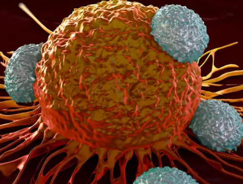 罕见的免疫细胞癌症与骨髓和吸烟中的基因突变有关