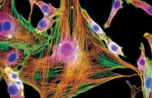 成纤维细胞可以作为增强肺癌患者个性化治疗的新关键