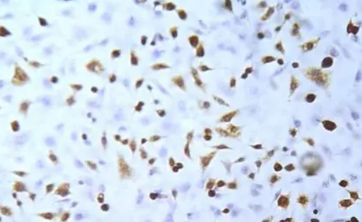 医学研究人员绘制了小鼠虹膜细胞类型图