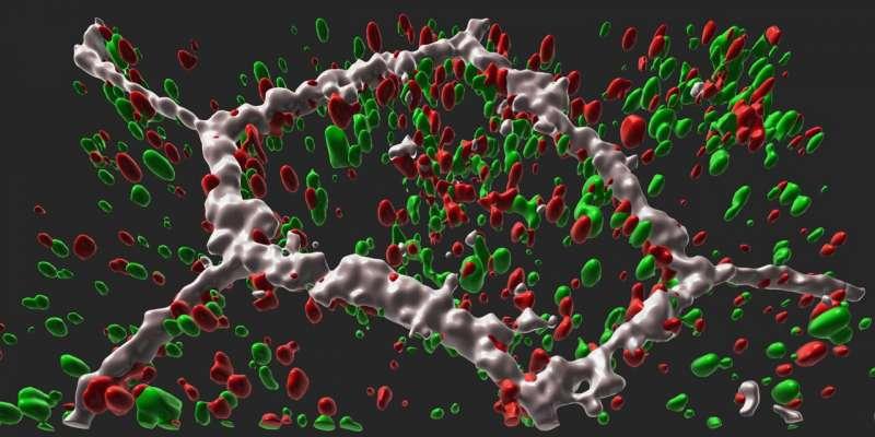 研究追踪从基因到迟发性视网膜的分子联系