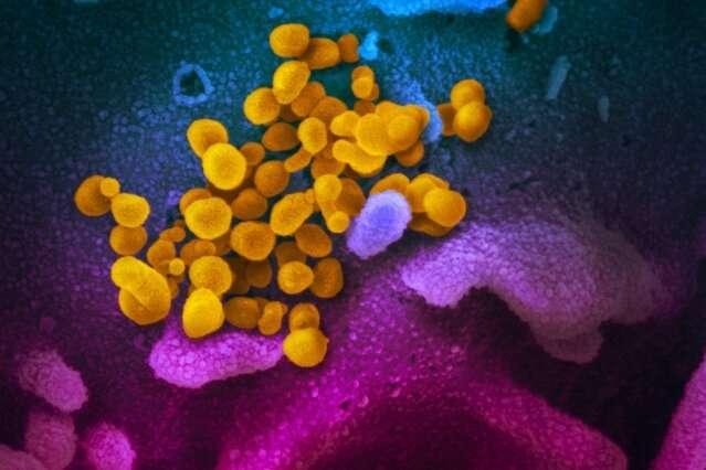 科学家称新的高度准确的病毒检测可在几分钟内给出结果