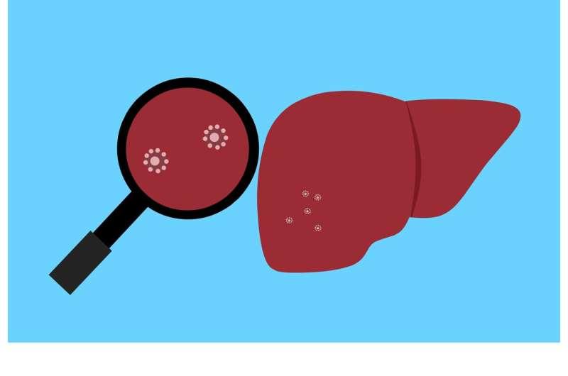 研究人员恢复可以抑制肝癌和增强免疫治疗的基因的功能