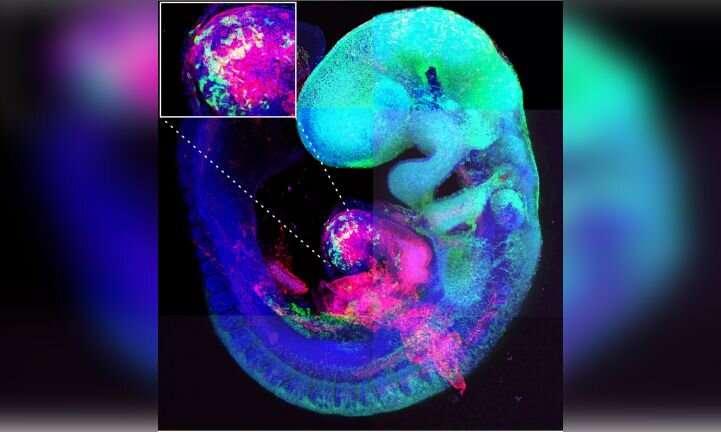 科学家发现一种可以修复先天性心脏缺陷的基因