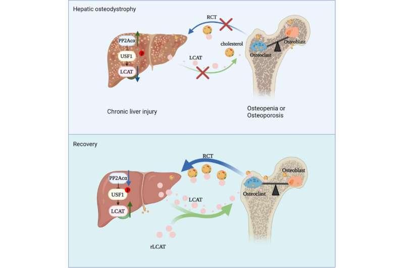 3月2日科学家揭示慢性肝损伤如何导致骨质流失