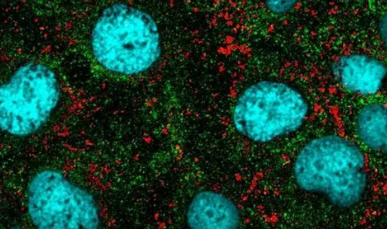 3月7日新的荧光 DNA 标记揭示了纳米级癌症特征