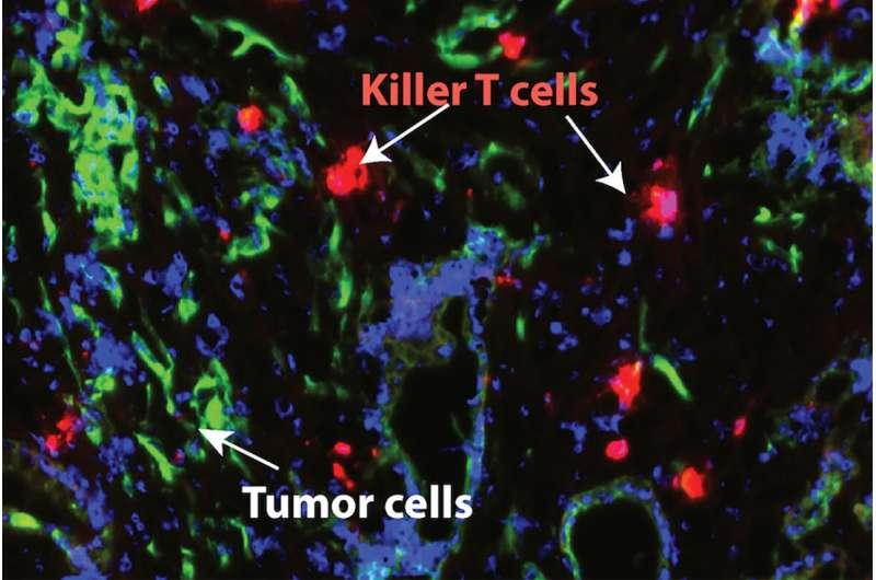 小鼠研究表明新疗法使胰腺癌易受免疫疗法的影响