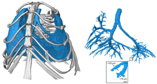 方法提供了更清晰的活体小鼠肺部疾病图像
