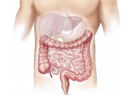 一系列新研究揭示了肠道微生物如何抑制肠道炎症
