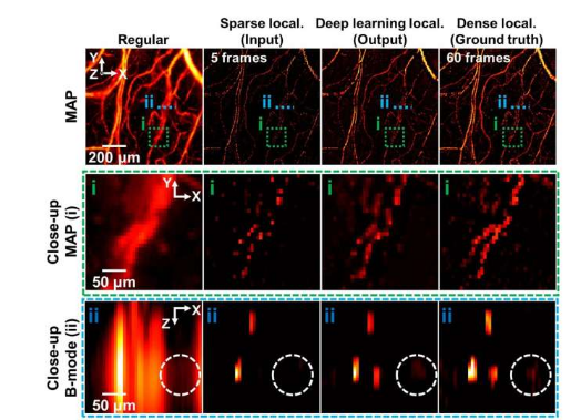 人工智能技术加速血管超分辨率定位光声成像
