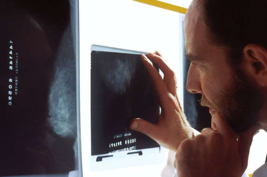 新的联合疗法有助于延长前列腺癌患者的生命