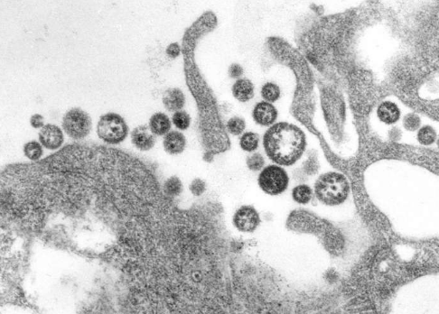科学家发现阻止拉沙病毒感染的线索