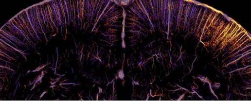 功能超声显微镜：在微米尺度上感知全脑神经元活动