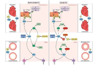 Nitroxyl 可能是治疗 2 型糖尿病心血管急症的有前途的治疗干预措施