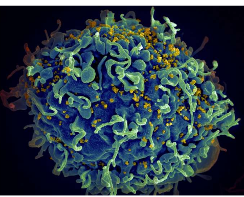 更持久的 HIV 抗体治疗可以为维持治疗提供一次性替代方案