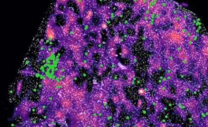 研究表明某些癌症如何中和T细胞以破坏免疫系统并帮助肿瘤生长